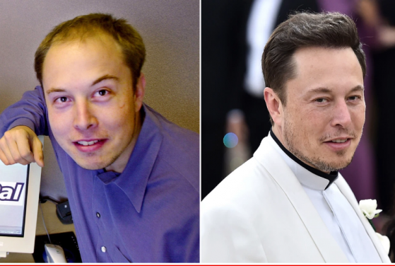 Elon Musk IQ and a few other facts about Elon you don't know