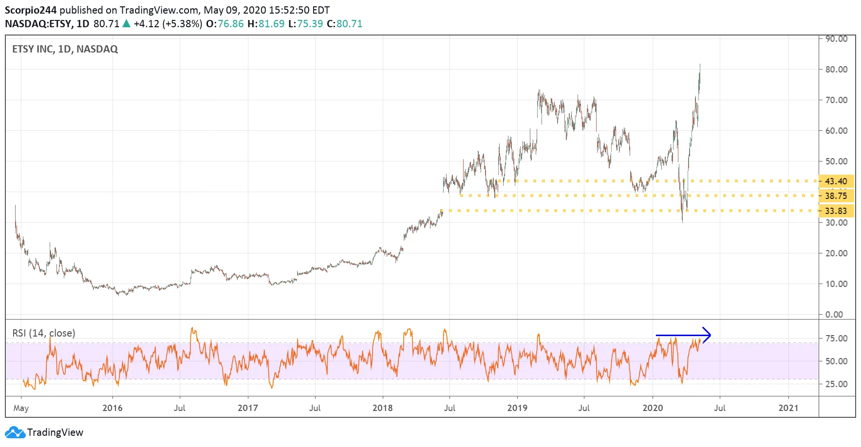 ETSY Inc Daily Chart